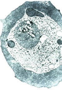 Lĩnh vực từ tính - Một liệu pháp mới trong điều trị sốt rét