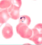 Sản xuất vaccine phòng chống sốt rét: bây giờ hay đến bao giờ?