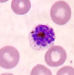 Diệt ký sinh trùng ngay trong cơ thể muỗi - Muỗi chuyển gen ?