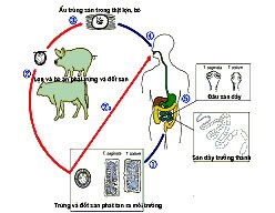 Bệnh sán dây và vệ sinh an toàn thực phẩm