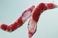 Cả nhà bị nhiễm sán lá ruột. Bệnh gây nên có nguy hiểm không ?