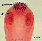 Bệnh sán dây và ấu trùng sán dây lợn (Tapeworm Diseases and cysticercosis)