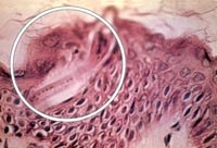 Kết quả điều tra về tình hình nhiễm giun móc/mỏ tại một số tỉnh khu vực miền Trung-Tây Nguyên