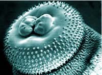 Giun đầu gai do Gnathostoma spinigerum, một bệnh ký sinh trùng ở người đang được quan tâm