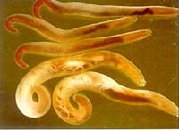 Luận bàn về căn bệnh ký sinh trùng mới nổi qua một số ca bệnh giun đầu gai Gnathostoma spinigerum