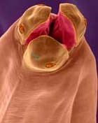 Cảnh giác bệnh ấu trùng giun đũa chó (Toxocara canis) lạc chủ sang người