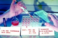 Phần I: Kỹ thuật In vivo, In vitro, PCR và đo nồng độ thuốc trong huyết tương trong nghiên cứu nhạy kháng thuốc sốt rét trên thế giới và Việt Nam