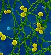 Leptospira-Tác nhân gây bệnh nguy hiểm thường gặp trong các vùng nhiệt đới