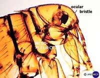 Bọ chét và ảnh hưởng của nó đối với sức khỏe con người