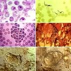 Giáo dục sức khỏe trong phòng chống bệnh ký sinh trùng đường ruột ở người