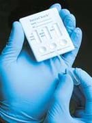 Phát hiện nhanh bệnh cúm A (H5N1) ở người qua nước bọt