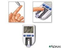 Khi nào chúng ta cần chỉ định xét nghiệm Hemoglobin A1c (HbA1c)