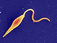 Leishmania sp. và bệnh Leishmaniasis