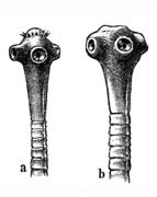 Bệnh sán dây (Taeniasis)