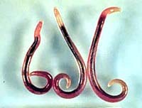 Hiện tượng giun lạc chủ và hội chứng ấu trùng di chuyển ở người