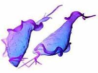 Bệnh lý viêm sinh dục do nhiễm trùng roi âm đạo Tricomonas vaginalis