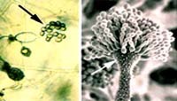 Vi nấm Aspergillus flavus gây bệnh ở người