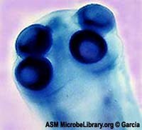 Phát hiện một ổ bệnh sán dây bò tại xã Đak Mon, huyện ĐakGlei, tỉnh Kon Tum