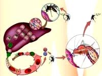 Thiếu máu và biến đổi máu do bệnh sốt rét