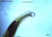 Việt Nam có giun mỏ không ?