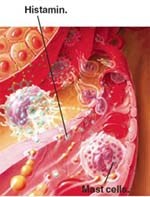 An toàn và hợp lý trong sử dụng thuốc kháng Histamine trong điều trị bệnh ký sinh trùng ở người