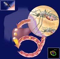 Biến đổi gan do bệnh sốt rét