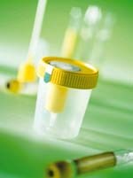 Những thử nghiệm PCR mới phát hiện ký sinh trùng sốt rét trong nước tiểu hay nước bọt khá quan hơn trong máu