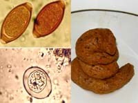 Xét nghiệm đánh giá mẫu phân tổng thể-Một khâu quan trọng trong phát hiện chẩn đoán bệnh ký sinh trùng đường ruột