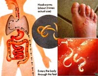 Giám sát thường quy và cảnh báo sớm tình hình kháng thuốc điều trị của giun móc