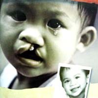 Điểm báo về các thông tin liên quan đến y tế ngày 6, 7 & 8 tháng 11 năm 2009