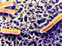 Bệnh lỵ amíp và lỵ trực khuẩn có gì khác biệt ?