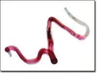 Bộ gen của ký sinh trùng gây bệnh sán máng được giải mã