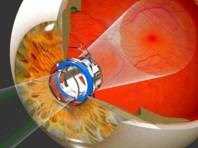 Tiếp cận một số thông tin chẩn đoán sốt rét mới trên thế giới