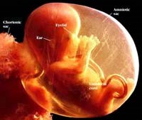 Điểm báo về các thông tin liên quan đến y tế ngày 2 & 3 tháng 12 năm 2009