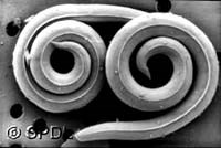 Tại sao tỷ lệ mắc bệnh giun đũa chó/mèo (Toxocara spp.) theo chẩn đoán huyết thanh ELISA lại cao như hiện nay