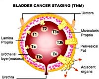Tiếp cận một số phương pháp chẩn đoán ung thư mới
