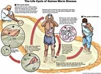Cập nhật thông tin về một bệnh da do giun chỉ Dracunculus medinensis ký sinh và gây bệnh ở người