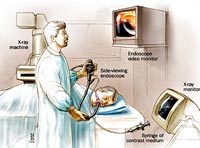 Thông tin cập nhật về nghiên cứu bệnh sán lá gan lớn trên thế giới