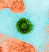 Một loại Protein ở người giúp ngăn nhiễm virus H1N1 và một số loại virus khác