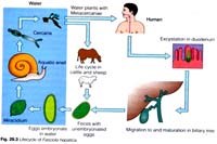 Ca bệnh sán lá gan lớn: sốt không rõ nguyên nhân và tăng bạch cầu ái toan dai dẳng