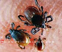 Bạn biết gì về bệnh Lyme ?