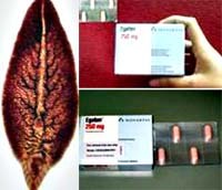 Sự bùng nổ của bệnh sán lá gan lớn và những giải pháp can thiệp y tế