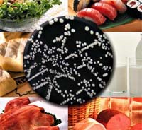 Bệnh Listeriosis do nhiễm khuẩn Listeria monocytogenes