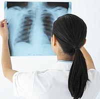 Điểm báo về các thông tin liên quan đến y tế ngày 24 & 25 tháng 3 năm 2010