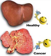 Ngày ung thư thế giới năm 2010 với chủ đề “có thể phòng ngừa được bệnh ung thư” (World Cancer Day with “Cancer can be prevented too”slogan)