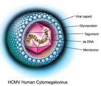 Tác dụng tiềm năng kháng virus của Artesunate trên một bệnh nhân nhiễm Cytomegalovirus (CMV) muộn kháng thuốc chống virus sau ghép tuỷ tế bào gốc