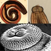 Cần nghiên cứu thêm về thuốc điều trị bệnh lý giun đầu gai (Gnathostoma spinigerum) ở người