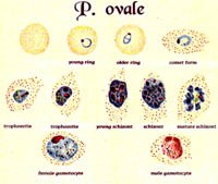Chú ý phát hiện loại ký sinh trùng sốt rét hiếm gặp