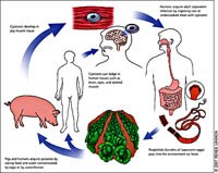 Bệnh ấu trùng sán lợn (Cysticercosis: An Emerging Human Parasitic Disease) một Một bệnh ký sinh trùng ở người đang nổi