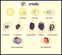 Ký sinh trùng sốt rét Plasmodium ovale với diển tiến “ngủ đông” trong gan cần lưu ý